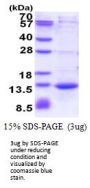 Human CAMK2N1 Recombinant Protein