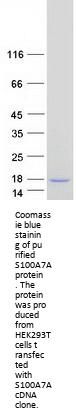NICE2 (S100A7A) (NM_176823) Human Recombinant Protein