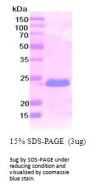 Human Podoplanin/PDPN Recombinant Protein