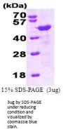 Human HOMER1 Recombinant Protein