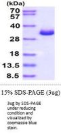 Mouse Galectin-3 Recombinant Protein