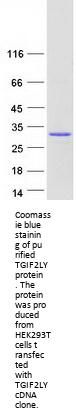 TGIF2LY (NM_139214) Human Recombinant Protein