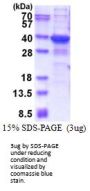 Human TGIF2LX Recombinant Protein