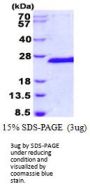 Human SIAH1 Recombinant Protein