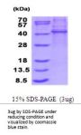 Human KLHDC8B Recombinant Protein