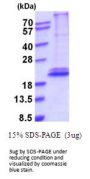 Human IFNL3 Recombinant Protein