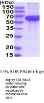Human KIR2DL5A Recombinant Protein