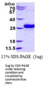 Human UBE2J2 Recombinant Protein