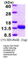 Human TSTD1 Recombinant Protein