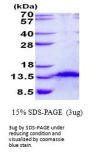 Human FDCSP Recombinant Protein