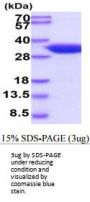 Mouse Hpgd Recombinant Protein