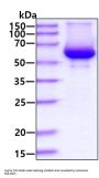Mouse Carboxylesterase 1/CES1 Recombinant Protein