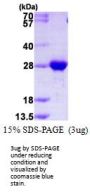 Human RAB2B Recombinant Protein