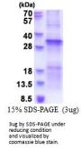 Human TGFBRAP1 Recombinant Protein