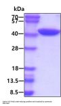 Human Alix Recombinant Protein