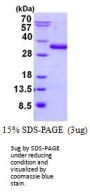 Human UBTD2 Recombinant Protein