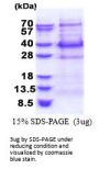 Human BCL7C Recombinant Protein