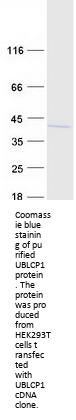 UBLCP1 (NM_145049) Human Recombinant Protein