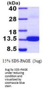 Human S100Z Recombinant Protein
