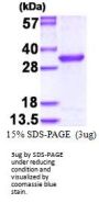 Human OVCA2 Recombinant Protein
