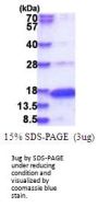 Human Neurogranin Recombinant Protein