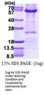 Human Histone Deacetylase 2/HDAC2 Recombinant Protein