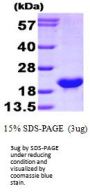 Human Bcl-w Recombinant Protein