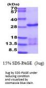 Human UBE2E3 Recombinant Protein