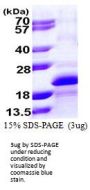 Human MYLPF Recombinant Protein