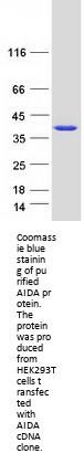 C1orf80 (AIDA) (NM_022831) Human Recombinant Protein