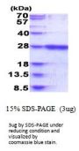 Human RAB39B Recombinant Protein