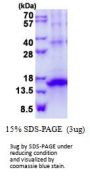 Human KLRG1 Recombinant Protein