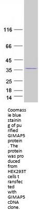 GIMAP5 (NM_018384) Human Recombinant Protein