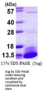 Human DYNLL2 Recombinant Protein