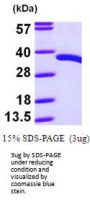 Human PDXP Recombinant Protein