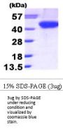 Human Aurora B Recombinant Protein