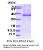 Human sFRP-2 Recombinant Protein