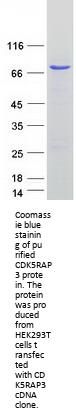 CDK5RAP3 (NM_176096) Human Recombinant Protein