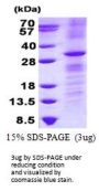Human RHOV Recombinant Protein
