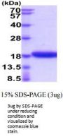 Human IL-17F Recombinant Protein