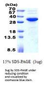 Human KCTD15 Recombinant Protein