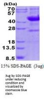 Human NEU-1/Sialidase-1 Recombinant Protein