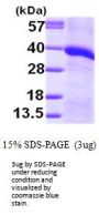 Human Monoglyceride Lipase/MGLL Recombinant Protein