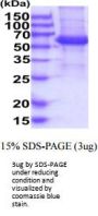Human KIR2DL4/CD158d Recombinant Protein