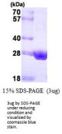Human HSD17B10 Recombinant Protein