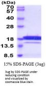 Human Chemerin Recombinant Protein