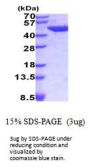 Mouse Acy1 Recombinant Protein