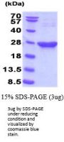 Mouse Park7/DJ-1 Recombinant Protein