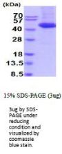 Rat IL11ra1 Recombinant Protein