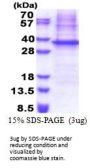 Human NIPSNAP1 Recombinant Protein
